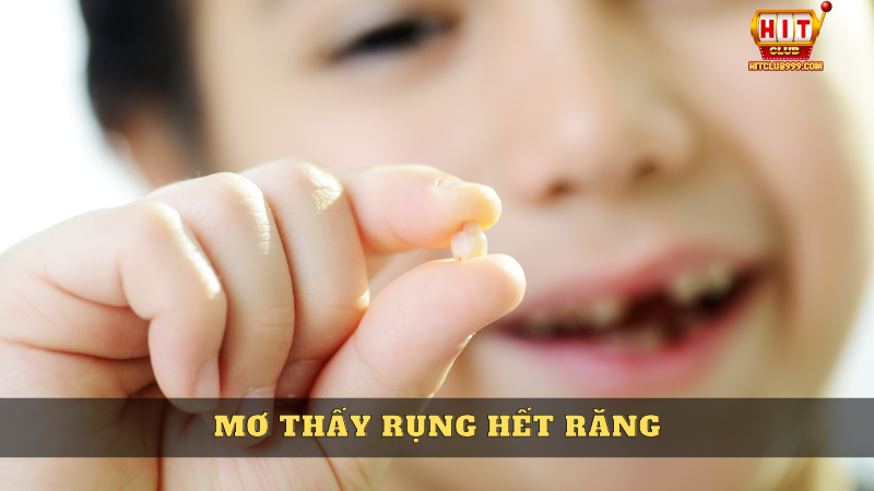 Mơ thấy rụng răng cho thấy vấn đề lo ngại về tài chính