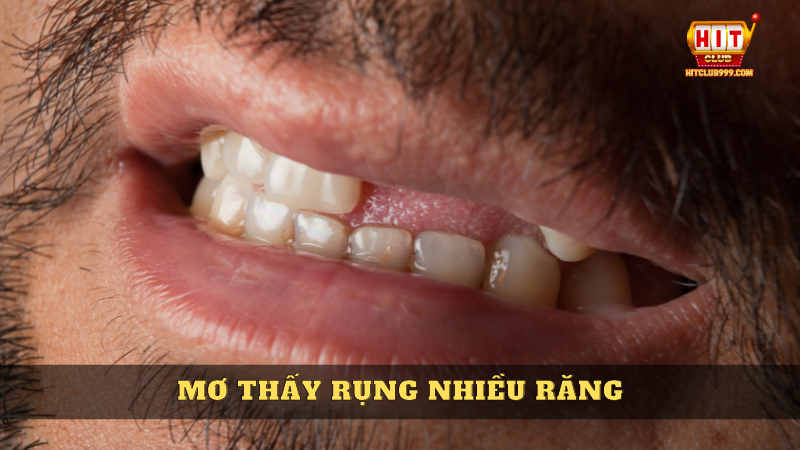 mơ thấy rụng răng cho thấy có sự thay đổi lớn trong cuộc sống