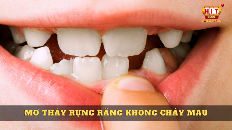 Mơ thấy rụng răng cũng có thể điềm báo sự may mắn